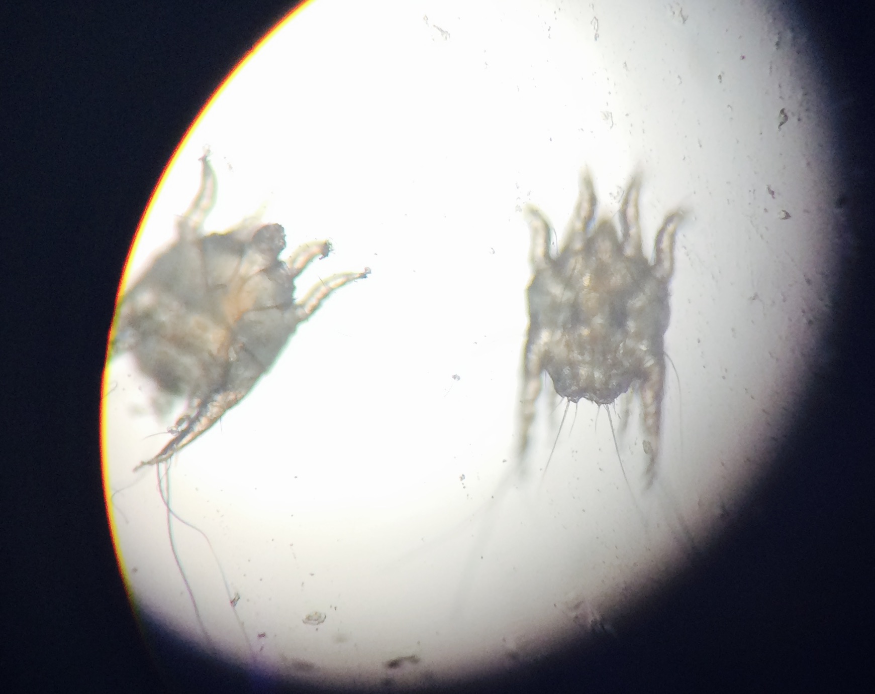 Milben unter dem Mikroskop Milben unter dem Mikroskop